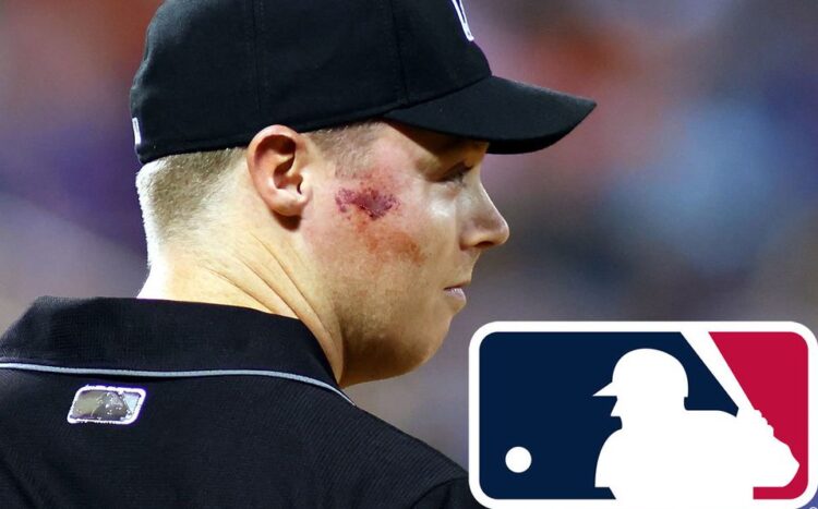 Ampáyer recibe brutal pelotazo en el rostro en la MLB (video)