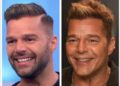 Ricky Martin niega cirugía en rostro: fue una alergia