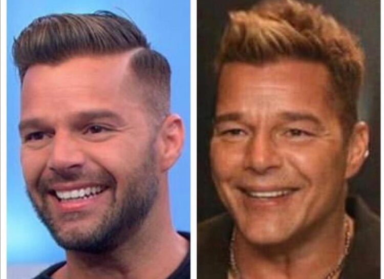 Ricky Martin niega cirugía en rostro: fue una alergia