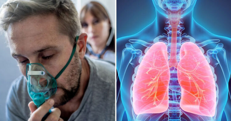 Mueren 22 personas al día por cáncer de pulmón en México