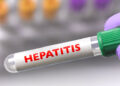 Detectan primer caso de hepatitis grave en América