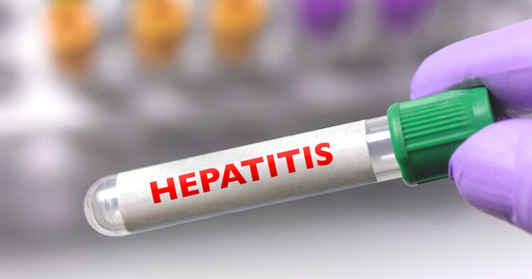 Detectan primer caso de hepatitis grave en América
