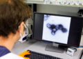 Descarta la OMS que brote de Viruela del Mono provoque una nueva pandemia