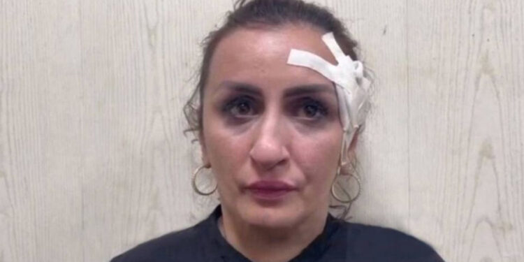 Mamá vende a su bebé recién nacido para operarse la nariz