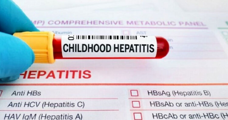 OMS registra más de mil casos de hepatitis infantil aguda en el mundo