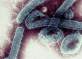 El nuevo virus ‘Marburgo’ preocupa a la OMS por no tener vacuna
