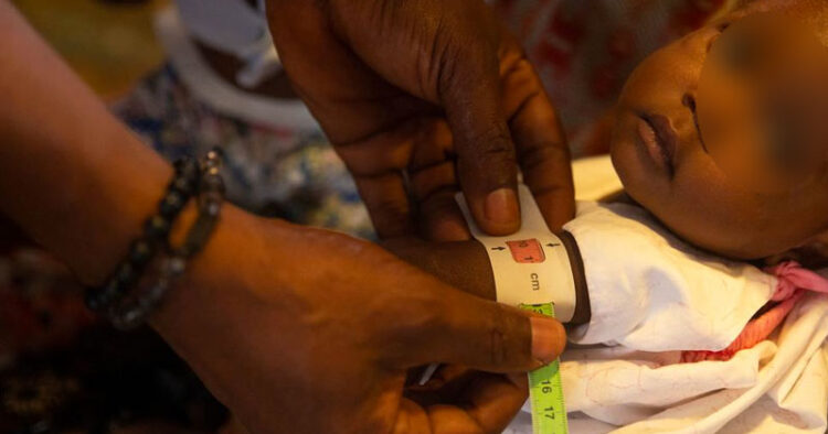 Niños de Haití son afectados por la desnutrición y el cólera según la ONU
