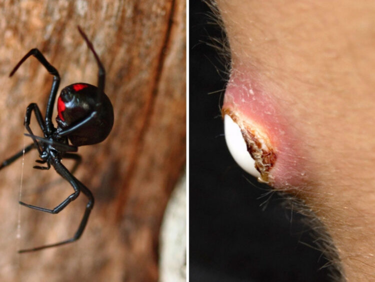 Menor se deja picar por araña viuda negra; quería convertirse en Spider – Man